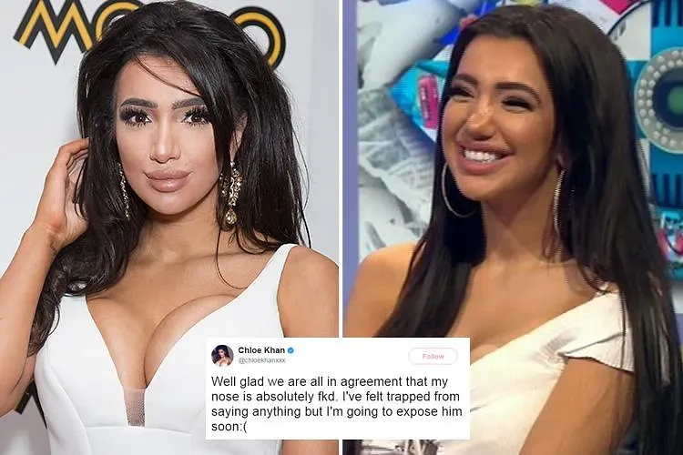 Chloe Khan vows to ‘expose’ surgeon who left her nose ‘f*****’