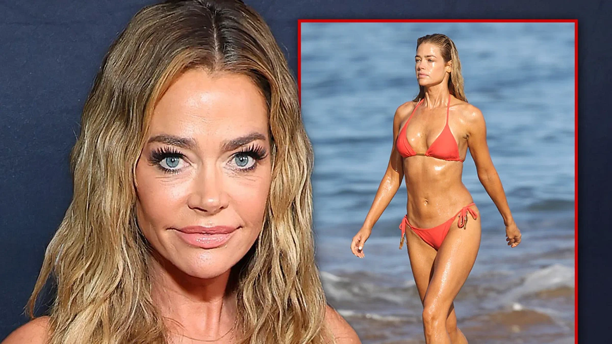 Denise Richards Eager for Next Bikini Season After Doctor Fixes Implants