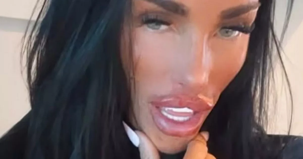 Celebs splashing out on 'designer vaginas' after Katie Price bombshell surgery news