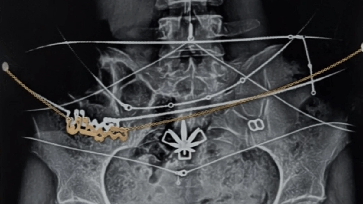 Mia Khalifa shares x-ray of her body to ‘reclaim’ image after leaving adult industry